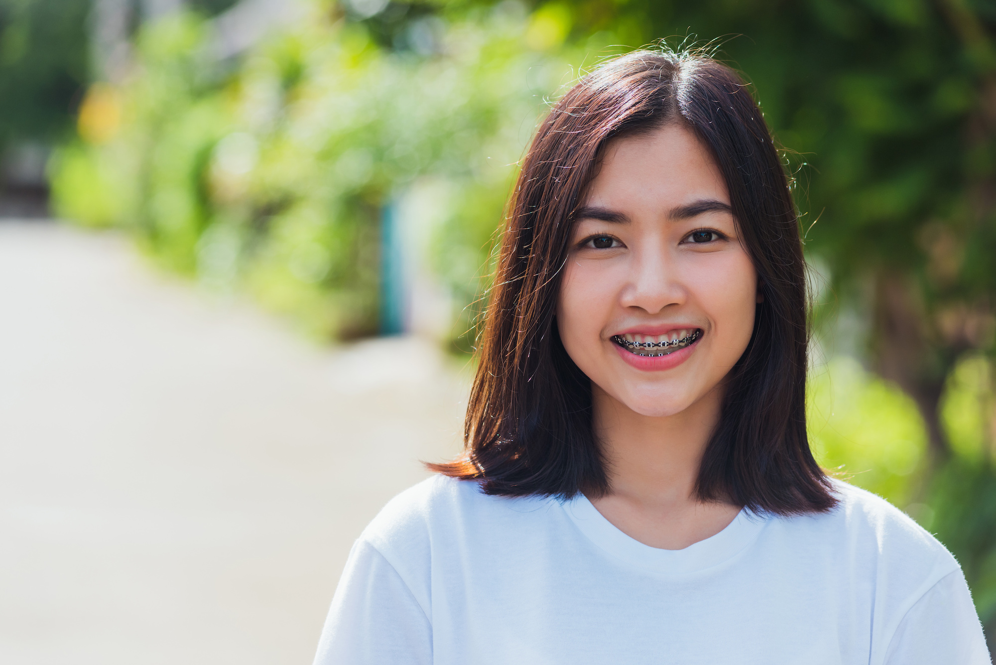 Metal vs. Ceramic Braces: Which Is Right for You?